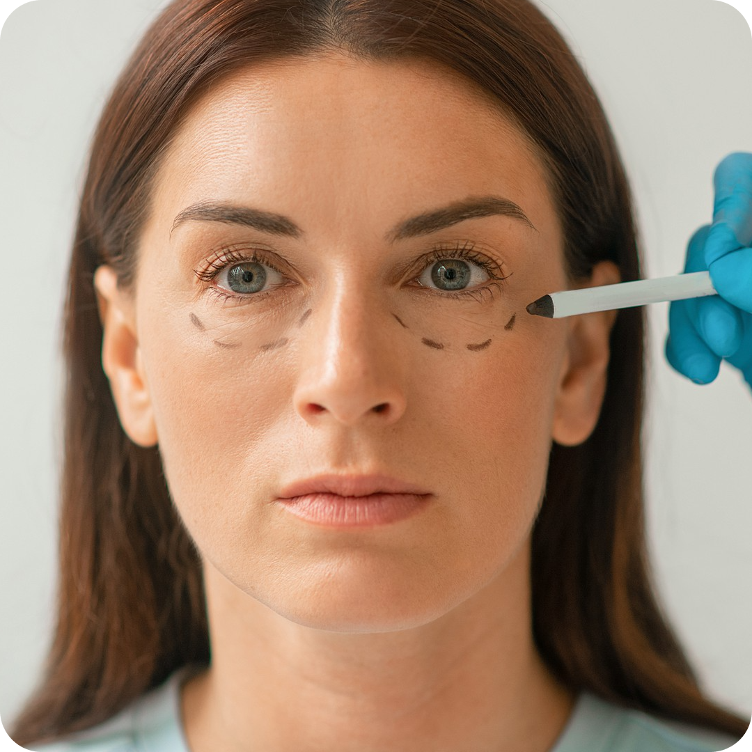 Preenchimento Palpebral